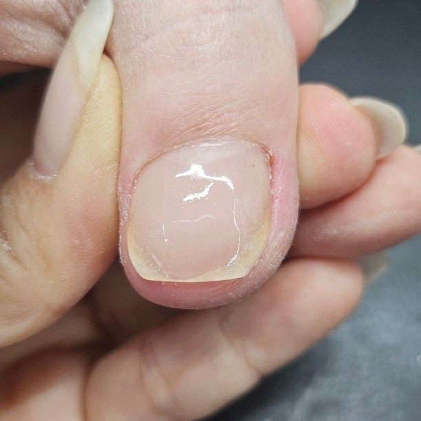 발톱 상태 확인과 기본 정리 후